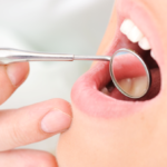 What Are The Most Common Dental Procedures?